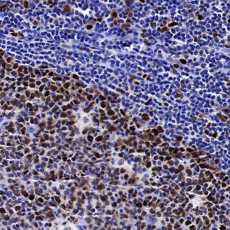 PCNA Recombinant Rabbit mAb (S-5313)