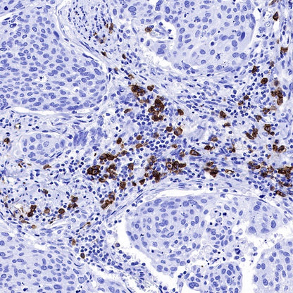 CD38 Mouse mAb (S-690-29)