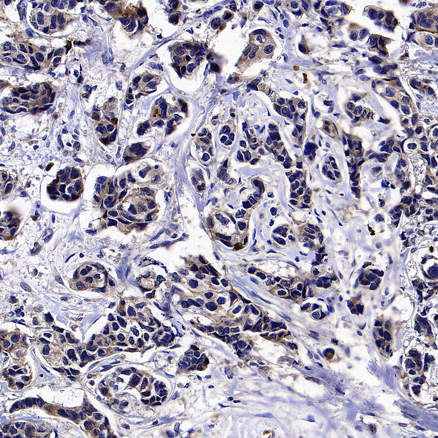 GPRC5A Recombinant Rabbit mAb (S-4383-15)