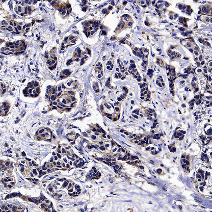 GPRC5A Recombinant Rabbit mAb (S-4383-15)