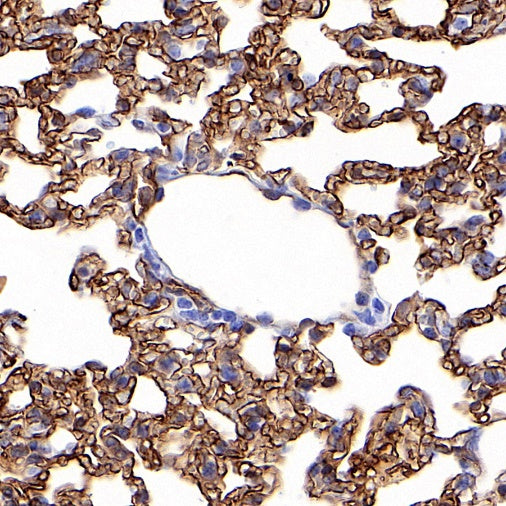 Claudin 5 Recombinant Rabbit mAb (SDT-R322)