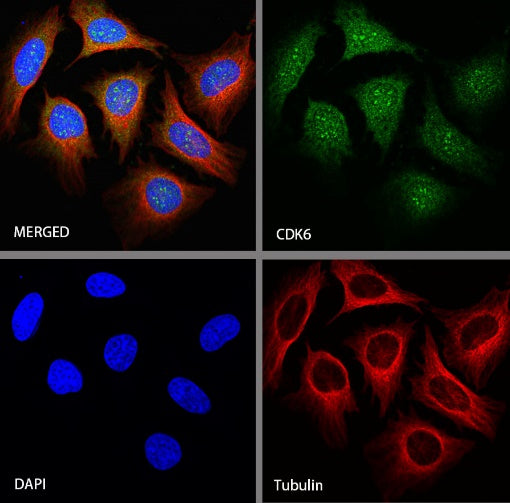 CDK6 Recombinant Rabbit mAb (S-1312-23)