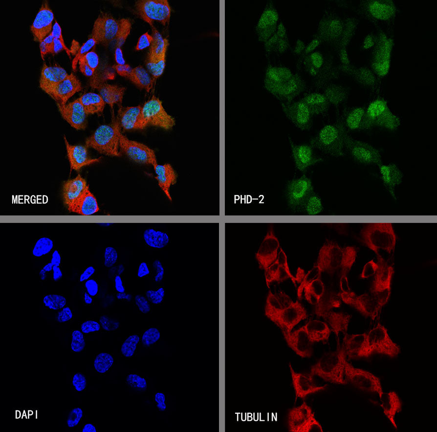 PHD-2 Recombinant Rabbit mAb (S-4111-17)