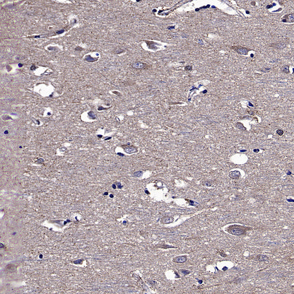 VPS34 Recombinant Rabbit mAb
