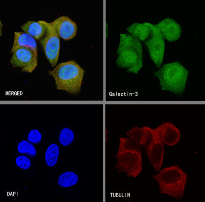 Galectin-3 Recombinant Rabbit mAb (SDT-370-111)