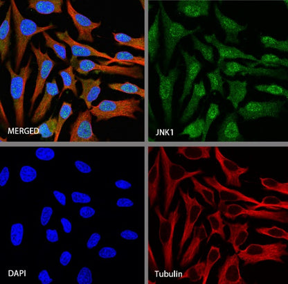 JNK1 Recombinant Rabbit mAb (S-1153-21)