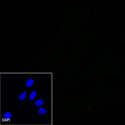 B7-H4 Recombinant Rabbit mAb (SDT-314-447-2)