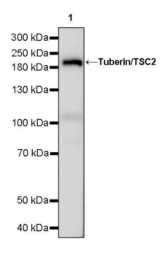 Tuberin/TSC2 Recombinant Rabbit mAb (S-1138-125)