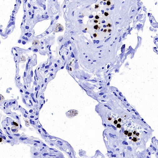 Lipocalin-2/NGAL Recombinant Rabbit mAb (S-2279-72)