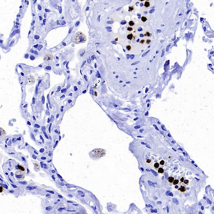 Lipocalin-2/NGAL Recombinant Rabbit mAb (S-2279-72)