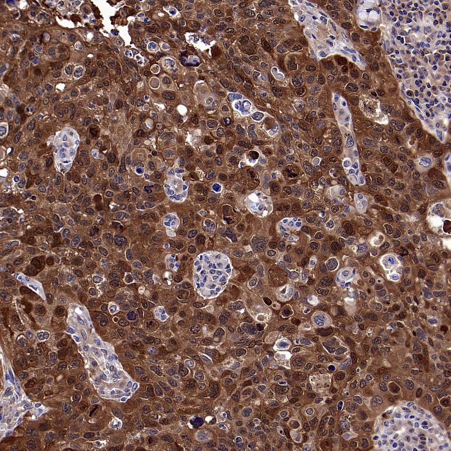 4E-BP1 Recombinant Rabbit mAb (S-4103-65)
