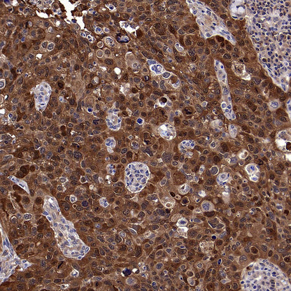 4E-BP1 Recombinant Rabbit mAb (S-4103-65)