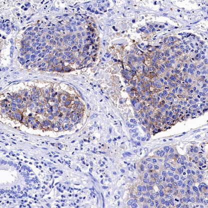 ENT1 Recombinant Rabbit mAb (SDT-R182)