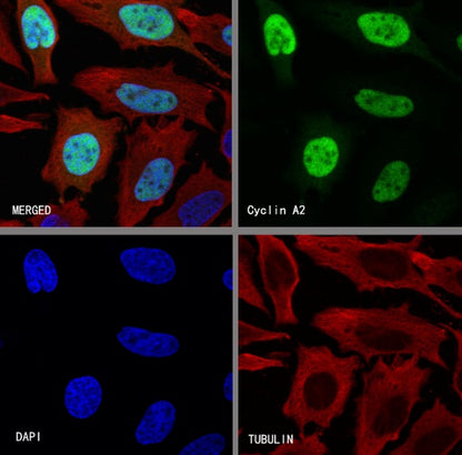 Cyclin A2 Recombinant Rabbit mAb (S-2554-2)