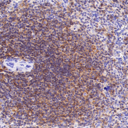 CD48 Recombinant Rabbit mAb (S-R265)