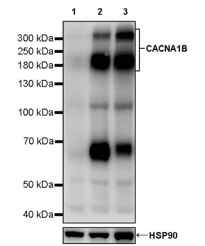 CACNA1B Recombinant Rabbit mAb (S-2992-33)