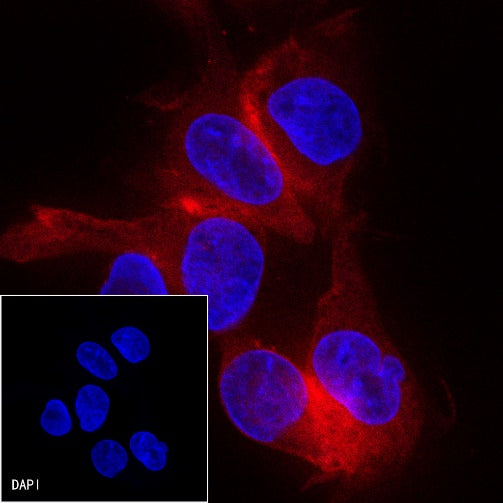β-tubulin Recombinant Rabbit mAb (PE Conjugate) (S-312-113)