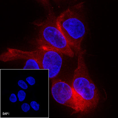 β-tubulin Recombinant Rabbit mAb (PE Conjugate) (S-312-113)