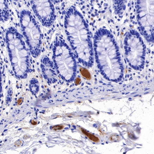 C1q Recombinant Rat mAb (S-R189)
