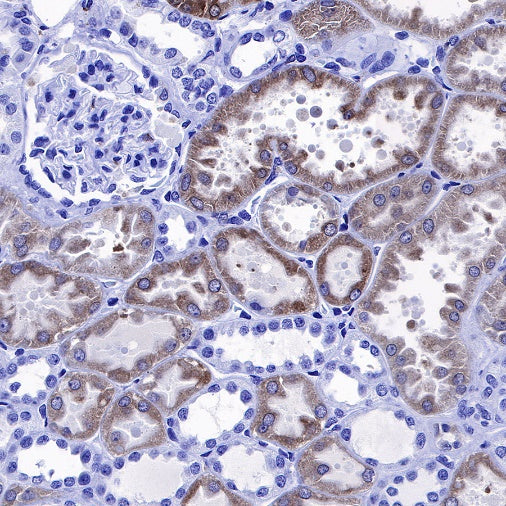 Heme Oxygenase 1 Recombinant Rabbit mAb (S-R334)