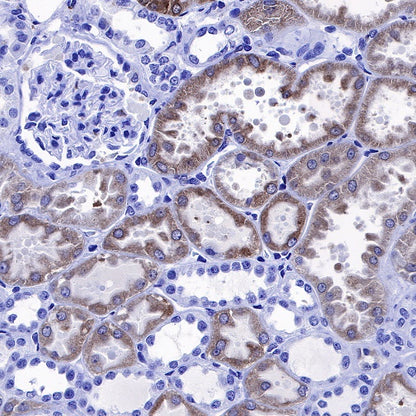 Heme Oxygenase 1 Recombinant Rabbit mAb (S-R334)