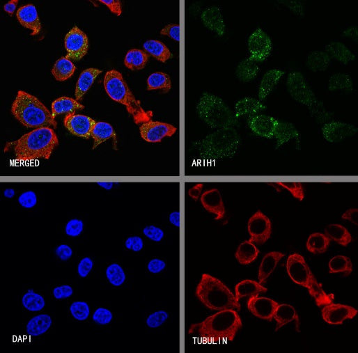 ARIH1 Recombinant Rabbit mAb (S-3166-64)