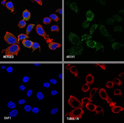 ARIH1 Recombinant Rabbit mAb (S-3166-64)