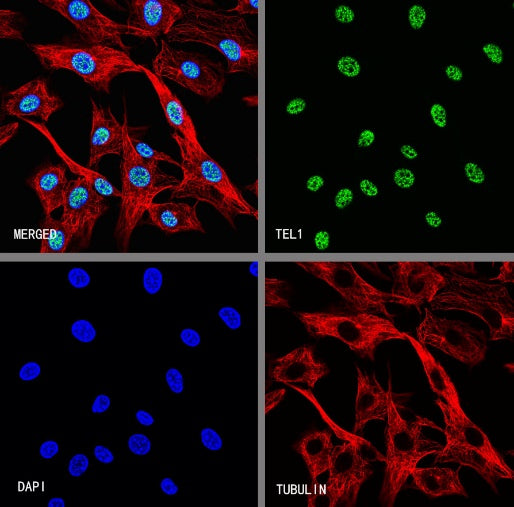 TEL1 Recombinant Rabbit mAb (S-3067-60)