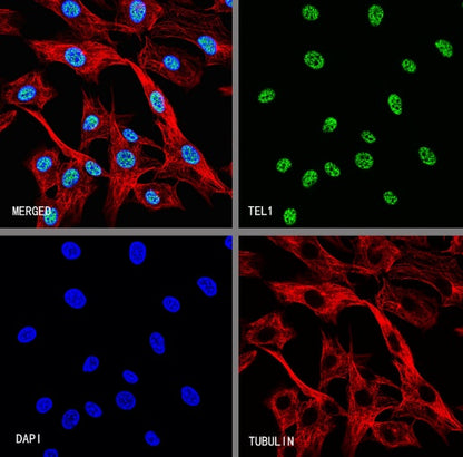 TEL1 Recombinant Rabbit mAb (S-3067-60)