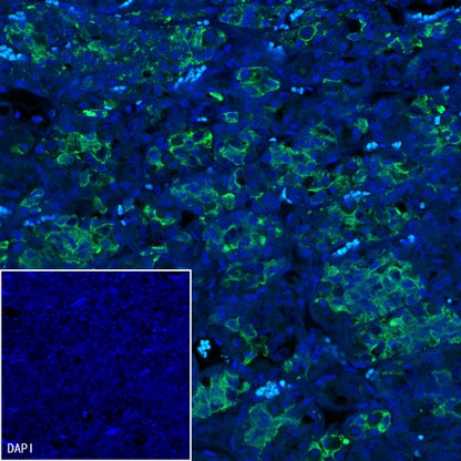 Prolactin/PRL Recombinant Rabbit mAb (S-235-215)