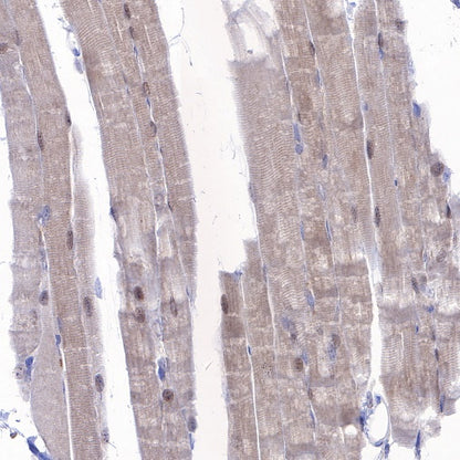 MEK3 Recombinant Rabbit mAb (S-835-23)