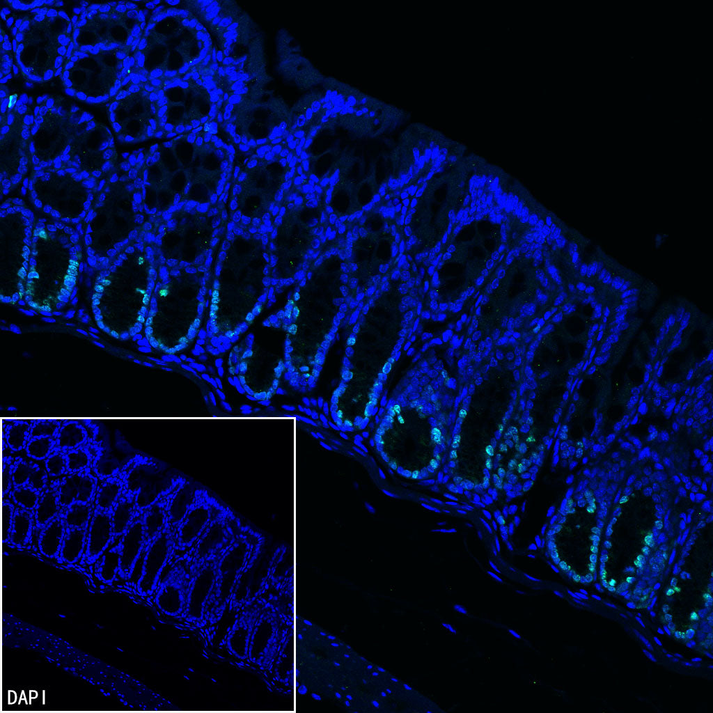 Ki67 Recombinant Rabbit mAb (S-4923-15)