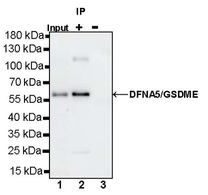 DFNA5/GSDME Recombinant Rabbit mAb (S-1703-1)
