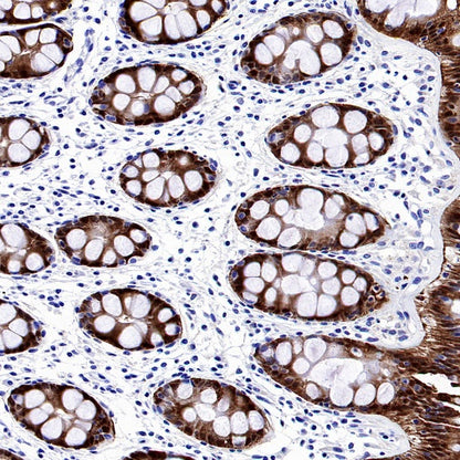 CA2 Rabbit Polyclonal Antibody
