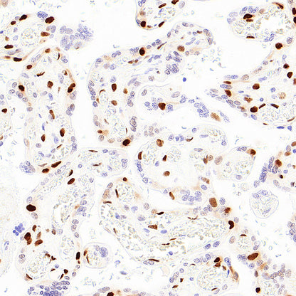 p57 Kip2 Recombinant Rabbit mAb (S-6119)
