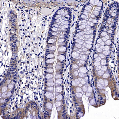 ROCK2 Rabbit Polyclonal Antibody