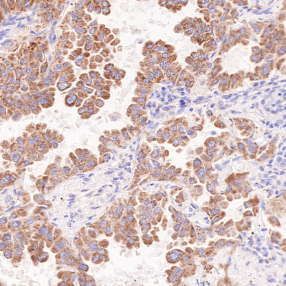 AMACR/p504s Recombinant Rabbit mAb (SDT-401-29)