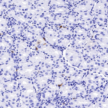 IDO1/Indoleamine 2,3-dioxygenase Recombinant Rabbit mAb (S-R225)