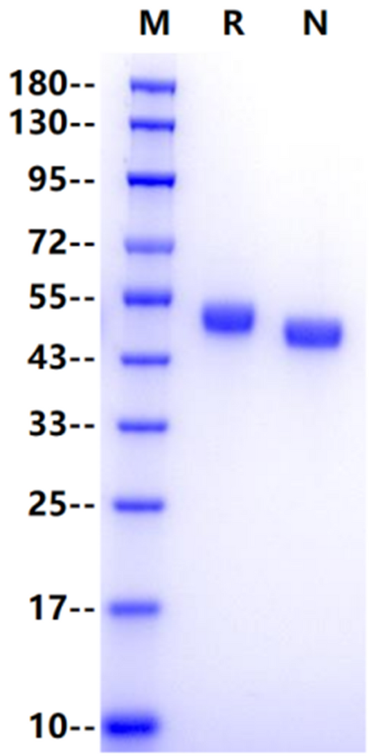 AGER His Tag Protein, Human