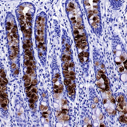 MUC5B Recombinant Rabbit mAb (SDT-2351-40)