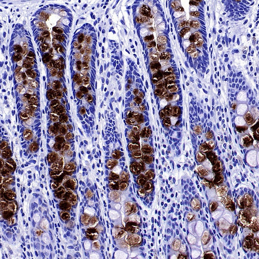 MUC5B Recombinant Rabbit mAb (SDT-2351-40)
