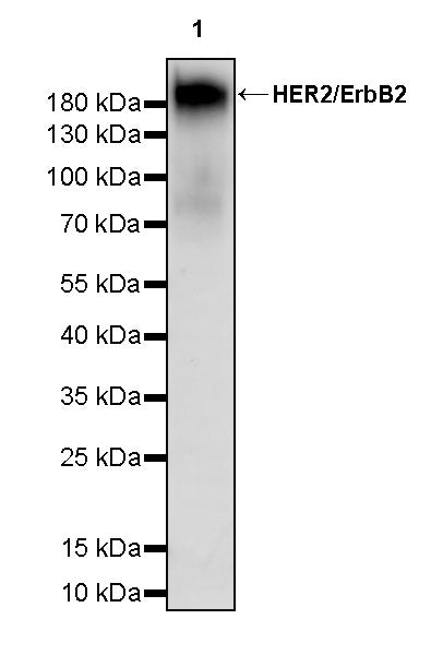HER2/ErbB2 Recombinant Rabbit mAb (S-3935-58)