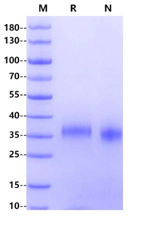 CLEC7A His Tag Protein, Cynomolgus