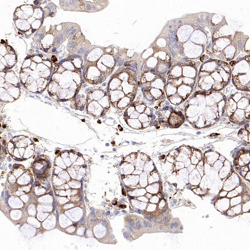 SEC23B Recombinant Rabbit mAb (S-1935-28)