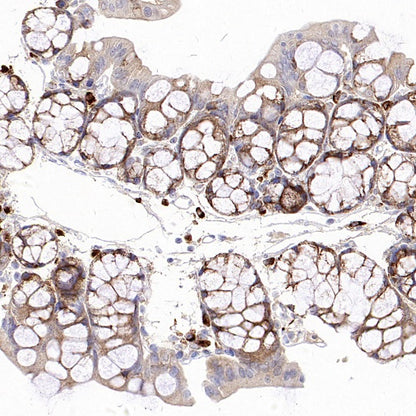 SEC23B Recombinant Rabbit mAb (S-1935-28)