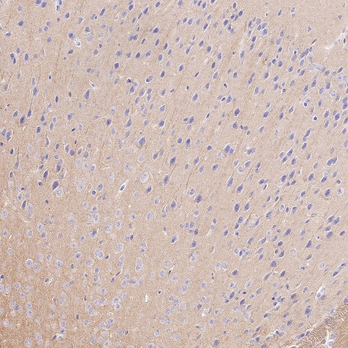 Beta I tubulin Recombinant Rabbit mAb (S-3108-63)