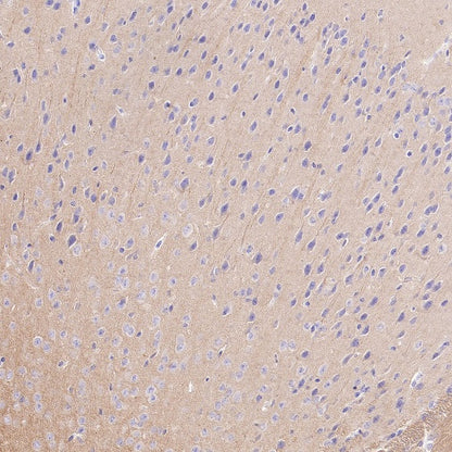 Beta I tubulin Recombinant Rabbit mAb (S-3108-63)