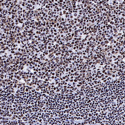 ARID1A Recombinant Rabbit mAb (S-440-62)