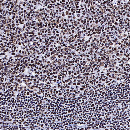 ARID1A Recombinant Rabbit mAb (S-440-62)