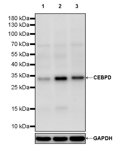 CEBPD Recombinant Rabbit mAb (S-2165-61)